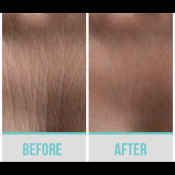 Chest wrinkle ease - Picture 6 of 6